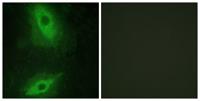 VEGI Polyclonal Antibody