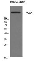 Versican Polyclonal Antibody