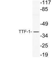 TTF-1 Polyclonal Antibody