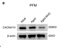 T-type Ca++ CP α1H Polyclonal Antibody