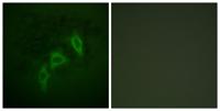 Tuberin Polyclonal Antibody