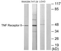 TNF-R2 Polyclonal Antibody