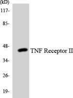 TNF-R2 Polyclonal Antibody