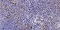 TNF-R2 Polyclonal Antibody