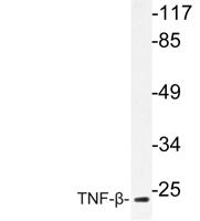 TNF-β Polyclonal Antibody