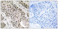 TNNI3K Polyclonal Antibody