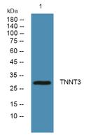 TNNT3 Polyclonal Antibody