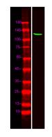 TOPRS Polyclonal Antibody