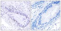 TP1 Polyclonal Antibody