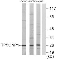 TP53INP1 Polyclonal Antibody