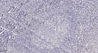 TP53INP1 Polyclonal Antibody