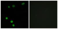 TP53INP2 Polyclonal Antibody