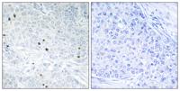 TP53INP2 Polyclonal Antibody