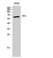 tPA Polyclonal Antibody