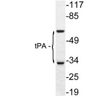 tPA Polyclonal Antibody