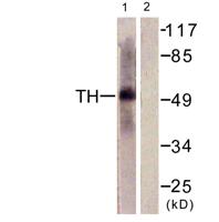 TPH1 Polyclonal Antibody