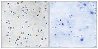 TPX2 Polyclonal Antibody