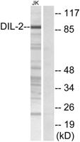 TPX2 Polyclonal Antibody