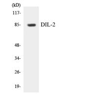 TPX2 Polyclonal Antibody