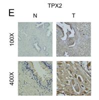TPX2 Polyclonal Antibody
