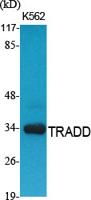 TRADD Polyclonal Antibody