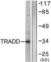 TRADD Polyclonal Antibody