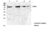 FOXP1 Polyclonal Antibody