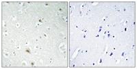 FoxR1 Polyclonal Antibody