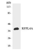 RFPL4A Polyclonal Antibody