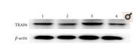 TRAF6 Polyclonal Antibody