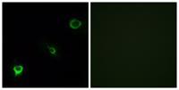 Tyk 2 Polyclonal Antibody