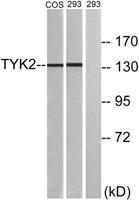 Tyk 2 Polyclonal Antibody