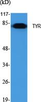 TYR Polyclonal Antibody