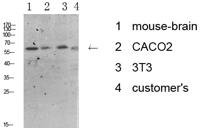 Tyrosine Hydroxylase Polyclonal Antibody