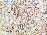 TyrRS Polyclonal Antibody