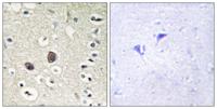 Tie-2 Polyclonal Antibody