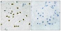 TIEG-1/2 Polyclonal Antibody