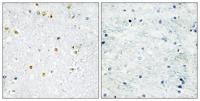 TIF1α Polyclonal Antibody