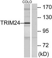 TIF1α Polyclonal Antibody