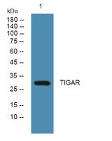 TIGAR Polyclonal Antibody