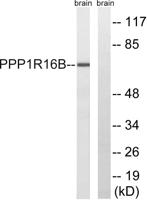 TIMAP Polyclonal Antibody