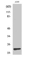 TIMP-2 Polyclonal Antibody