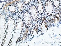 TIMP-2 Polyclonal Antibody