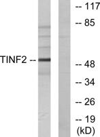 TIN2 Polyclonal Antibody