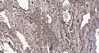 TIN2 Polyclonal Antibody