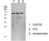 Tip60 Polyclonal Antibody