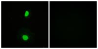 TIP60 Polyclonal Antibody