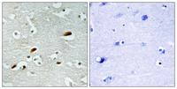 TIP60 Polyclonal Antibody