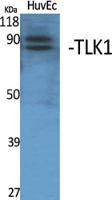 TLK1 Polyclonal Antibody