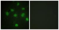 TLK1 Polyclonal Antibody